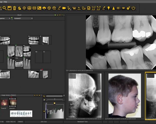 dental imaging software free download